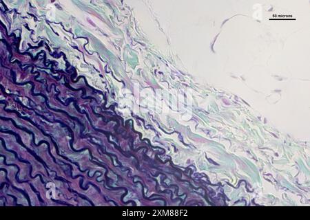 Artère en coupe mince sous microscope optique multipliée par 40 grossissements Banque D'Images