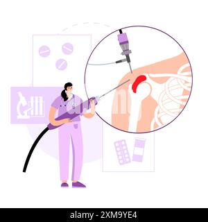 Illustration d'un procédé d'arthroscopie de l'épaule. Il s'agit d'une procédure de diagnostic et de traitement des problèmes articulaires. Un chirurgien insère un tube étroit attaché à une caméra vidéo à fibre optique à travers une petite incision. Banque D'Images