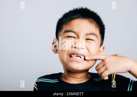 Garçon asiatique présentant la dentisterie pointant vers la dent de devant manquante. Concept de soins de santé isolé sur Banque D'Images