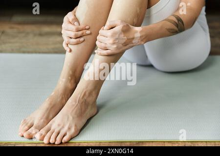 Une jeune femme atteinte de vitiligo est assise sur un tapis de yoga dans un appartement moderne, les jambes croisées et les mains reposant sur ses tibias. Banque D'Images