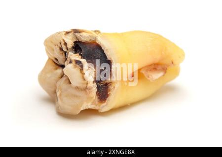 Dent de sagesse enlevée avec des caries isolées sur un fond blanc, gros plan macro. Dent numéro huit, photo très détaillée Banque D'Images