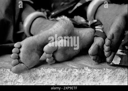 Repos Banjar femme tribale ont des pieds durs comme ils se rassemblent dans le dessert de Thar pour la foire de chameau de Pushkar , Pushkar Inde - 1989 Banque D'Images