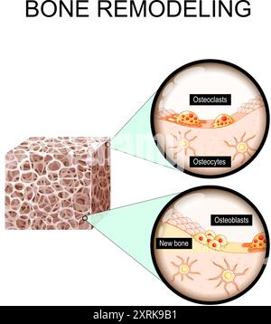 Remodelage osseux de la résorption à la formation osseuse nouvelle. Gros plan de la matrice osseuse trabéculaire, des ostéoblastes, des ostéoclastes et des ostéocytes. Illustration vectorielle Illustration de Vecteur