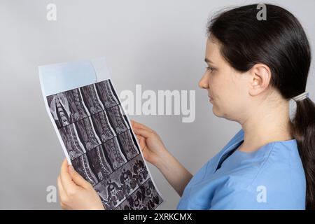 Le médecin détient une image IRM d'un patient présentant une protrusion de disque intervertébral et une arthrose de la colonne thoracique. Banque D'Images