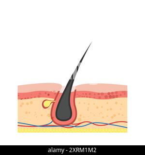 Follicule pileux humain. Problème de perte de cheveux. Illustration vectorielle dans un style plat Illustration de Vecteur