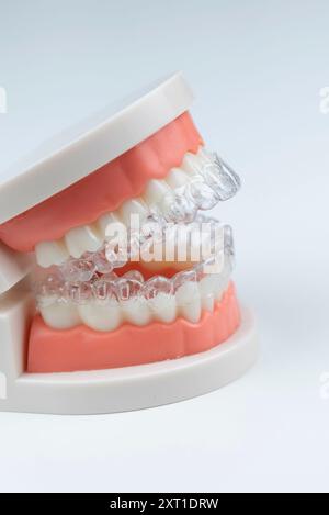 Gros plan. Aligneurs transparents pour dents de mâchoire artificielles. Banque D'Images