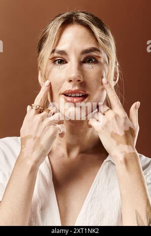 Une jeune femme au vitiligo pose dans une tenue d'été blanche sur un fond beige, mettant en valeur sa beauté unique. Banque D'Images