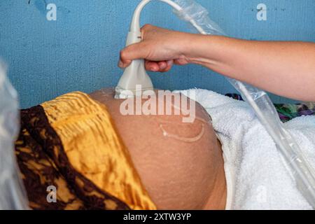 Échographie pour la surveillance de grossesse, centre de santé, San Bartolomé Jocotenango, Guatemala, Amérique centrale Banque D'Images