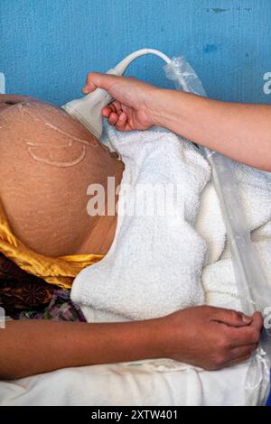 Échographie pour la surveillance de grossesse, centre de santé, San Bartolomé Jocotenango, Guatemala, Amérique centrale Banque D'Images