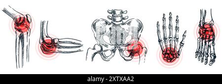 Arthrite articulaire, ostéoporose, maladie osseuse et inflammation. Symbole abstrait de localisation de la douleur. Illustration d'esquisse vectorielle. L'anatomie du doodle dessiné à la main Illustration de Vecteur