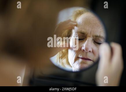 Symbolfoto zum Thema Migraene und Kopfschmerzen. Eine Frau reibt mit der hand an ihrem schmerzenden Kopf. Berlin, 13.08.2024. Berlin Deutschland *** S Banque D'Images