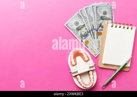 Composition de pose à plat avec modèle de typographie dentaire pédagogique et argent avec carnet sur table colorée, vue de dessus. Traitement coûteux. Banque D'Images