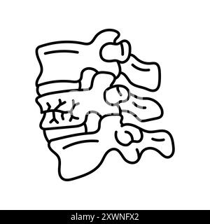 Icône noire de ligne de fracture par compression vertébrale. Signez pour la page Web, l'application mobile, le bouton, le logo. Bouton isolé de vecteur. Contour modifiable. Illustration de Vecteur