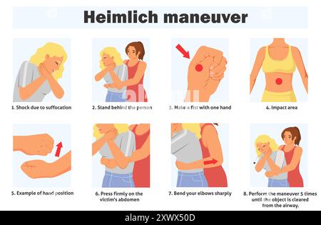 Affiche infographique de manœuvre de Heimlich avec étapes de premiers soins Illustration de Vecteur