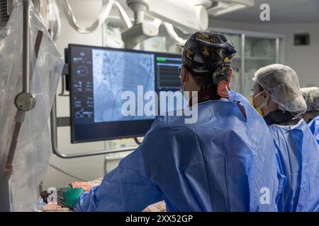 Denizli Turquie-28 février 2024 ; les médecins effectuent une opération diagnostique.coronarographie.intervention coronarienne percutanée-recanalisation, ballon angi Banque D'Images