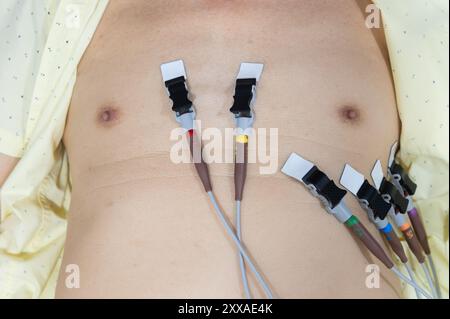 Gros plan d'un thorax d'homme avec électrodes de mesure de l'électrocardiographie Banque D'Images