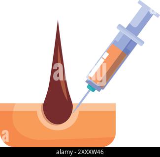 Professionnel de la santé donne une injection dans la peau pour favoriser la croissance des cheveux Illustration de Vecteur
