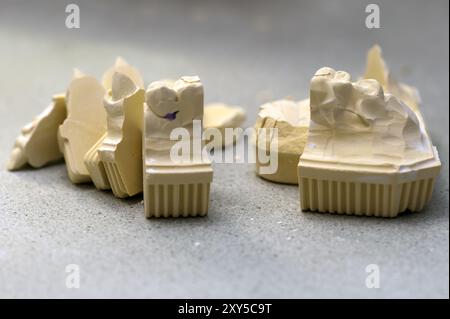 Pièces individuelles du modèle de mâchoire supérieure Banque D'Images