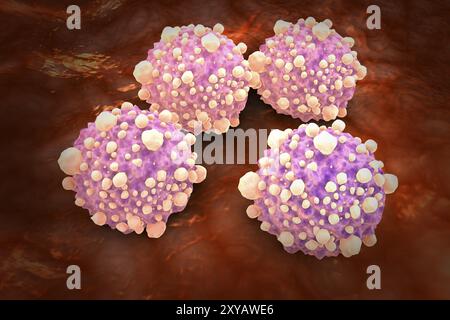 Vue microscipique des cellules cancéreuses pancréatiques Banque D'Images