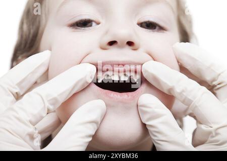 Médecine dentaire et soins de santé, dentiste examinant le petit enfant garçon patient bouche ouverte montrant caries dentaires caries Banque D'Images