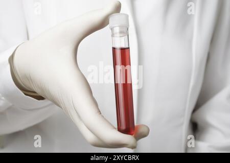 Doctor holding une bouteille d'échantillon de sang Banque D'Images