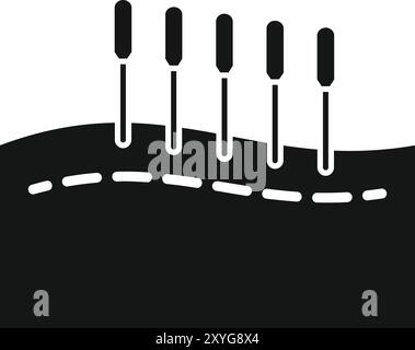 Des aiguilles d'acupuncture sont insérées le long d'un méridien sur le corps d'un patient pour traiter la douleur et rétablir la santé Illustration de Vecteur