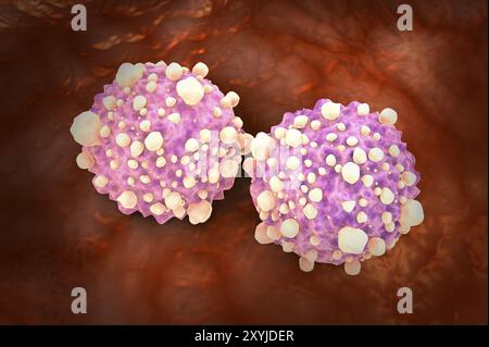 Vue microscipique des cellules cancéreuses pancréatiques Banque D'Images