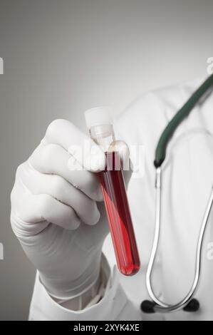 Doctor holding une bouteille d'échantillon de sang Banque D'Images