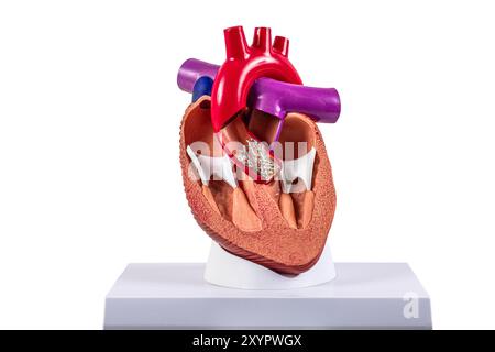 Modèle cardiaque d'implantation valvulaire aortique transcathéter (TAVI) pour l'éducation. Transplantation cardiaque et concept de chirurgie, shunting. Homme plastique HE Banque D'Images