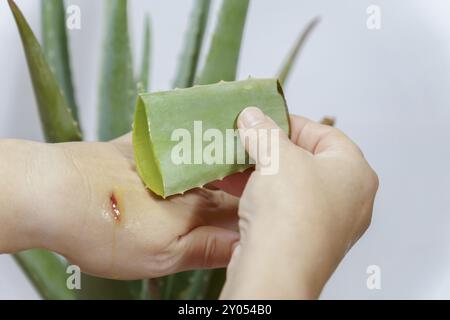 Gros plan d'une femme mettant de l'aloe vera frais sur une brûlure sur sa main avec une plante d'aloès en arrière-plan Banque D'Images