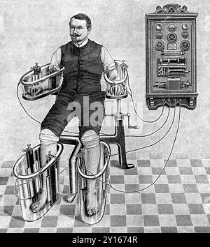 Illustration d'un patient traité avec un bain Schnee à quatre cellules, un équipement médical électrique précoce pour traiter les rhumatismes Banque D'Images