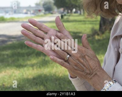 Une femme âgée masse ses mains avec de la crème hydratante, prenant soin de sa peau vieillissante dans un cadre extérieur paisible Banque D'Images