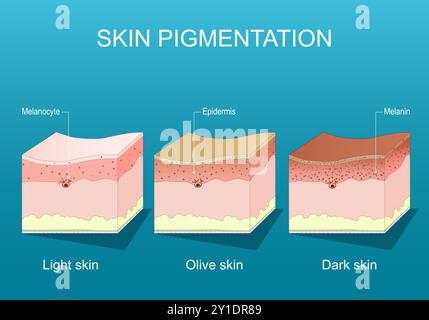 Pigmentation cutanée. Coupe transversale d'un épiderme humain avec mélanocytes et mélanine. Gammes de couleurs de peau humaine. Peau claire, olive et foncée sur dos bleu Illustration de Vecteur