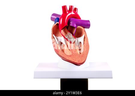 Modèle cardiaque d'implantation valvulaire aortique transcathéter (TAVI) pour l'éducation. Transplantation cardiaque et concept de chirurgie, shunting. Homme plastique HE Banque D'Images