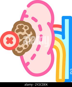 illustration vectorielle d'icône de couleur de chirurgie de néphrectomie Illustration de Vecteur