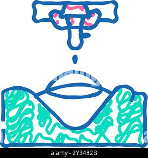 illustration de l'icône de correction ophtalmologique au laser Illustration de Vecteur