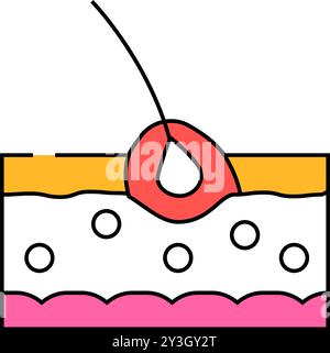 folliculite problème de maladie de peau icône couleur illustration Illustration de Vecteur