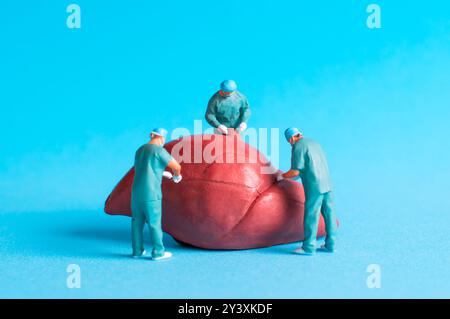 Équipe médicale miniature effectuant une chirurgie sur un modèle de foie humain sur un fond bleu vif, illustrant des procédures chirurgicales. Banque D'Images