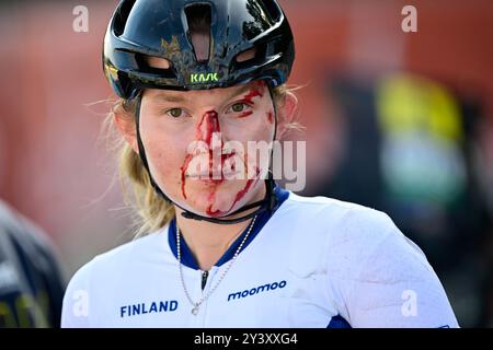 Hasselt, Belgique. 15 septembre 2024. Le Finlandais Turpeinen Viivi blessé après la Junior Road Race féminine au Championnat d'Europe 2024, à Hasselt, dimanche 15 septembre 2024. Les Championnats d'Europe sur route 2024 de l'UEC se dérouleront du 11 au 15 septembre à Limbourg, en Belgique. BELGA PHOTO DIRK WAEM crédit : Belga News Agency/Alamy Live News Banque D'Images