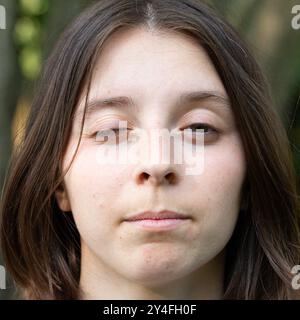 Portrait d'une belle femme à l'œil à moitié fermé atteinte de myasthénie grave Banque D'Images