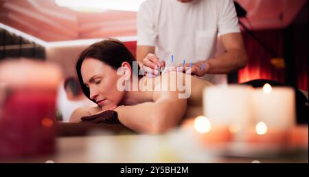 Traitement d'acupuncture à aiguille sèche. Thérapie Spa médicale féminine Banque D'Images
