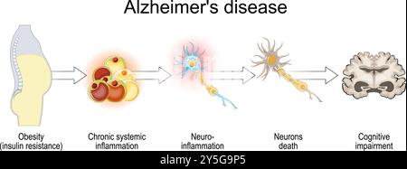 Maladie d'Alzheimer et insulinorésistance. Déclin cognitif. De l'obésité, l'inflammation systémique chronique à la mort des neurones après Neuro-inflammation an Illustration de Vecteur