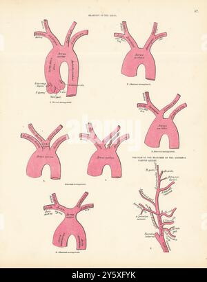 Anatomie. Branches de l'aorte, schéma de l'artère carotide externe 1880 ancien imprimé Banque D'Images