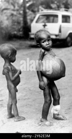 Ces enfants affamés de l'Etat sécessionniste du Biafra au Nigeria ont été photographiés vers la fin du mois dernier dans la région d'Umuahia . Deux des enfants souffrent de Kwashiorkor , une desiase de carence en protéines qui se montre dans l'estomac gonflé , les membres rétrécis , les plaies de jambe et les cheveux blancs . La maladie coûte la vie à des milliers d'enfants chaque semaine. 2 août 1968 Banque D'Images