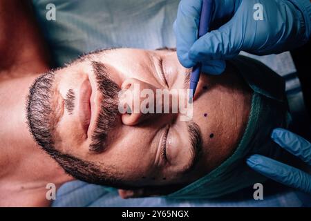 Un homme est allongé les yeux fermés alors qu'un chirurgien marque son visage avec un stylo, indiquant les zones à traiter pendant une intervention chirurgicale Banque D'Images