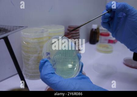 Scientifique travaillant avec une boîte de Pétri dans un laboratoire portant des gants bleus, menant des recherches microbiologiques. Banque D'Images