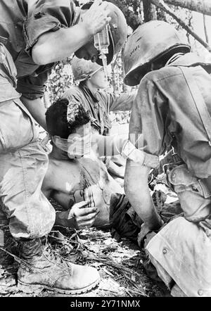 Une vallée de Shau, Sud Vietnam : les médecins s'occupent d'un soldat blessé en aérodrome frappé au visage par une main greande tout en prenant d'assaut ' Hamburger Hill ' surplombant la vallée De A Shau 24 mai 1969 Banque D'Images