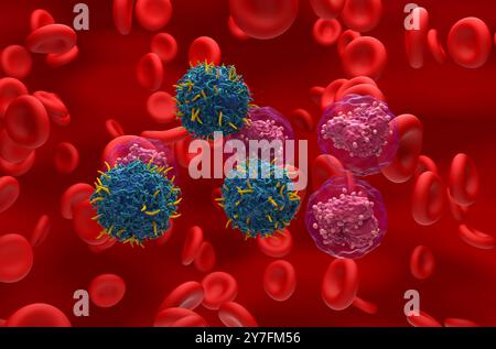 CAR T thérapie de cellules dans la leucémie lymphocytaire aiguë (LAL) - vue isométrique 3d illustration Banque D'Images