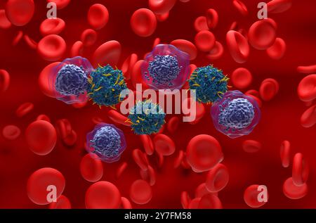 Thérapie par les cellules CAR T dans la leucémie myéloïde aiguë (LAM) - vue isométrique illustration 3D. Banque D'Images