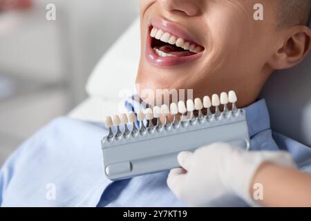 Docteur vérifiant la couleur des dents du jeune homme à la clinique, gros plan. Facettes dentaires Banque D'Images